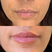 Velisse Invisible Lip Liner™